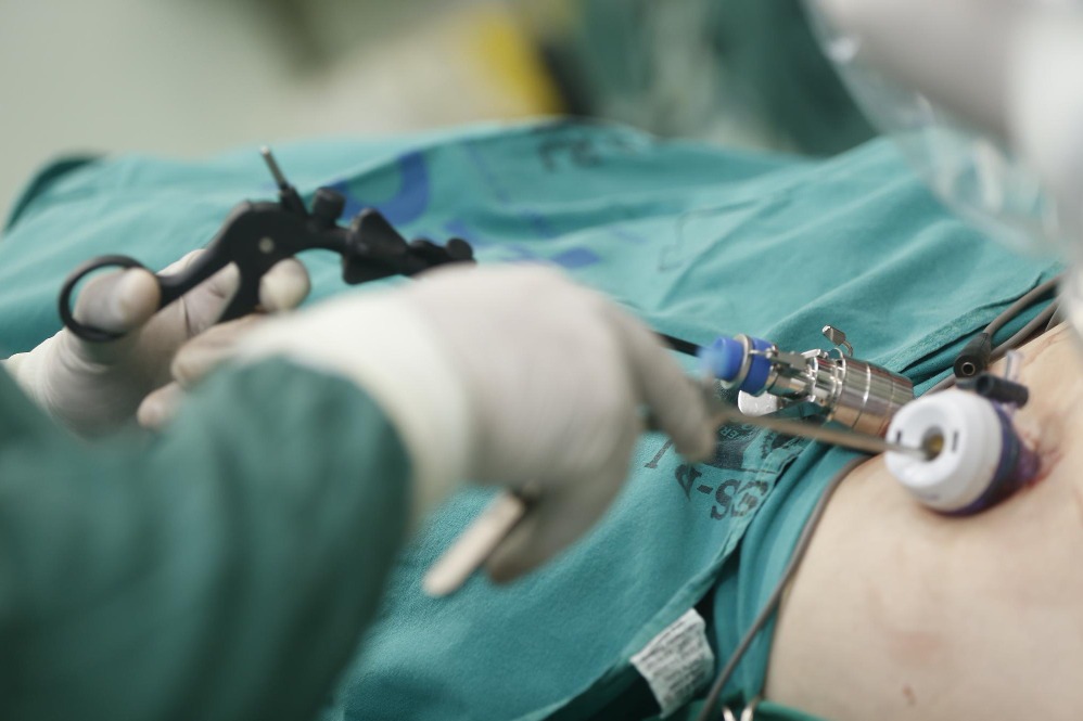 Laparoscopic Hysterectomy in Chennai and Key Questions to Ask Before the Procedure main image