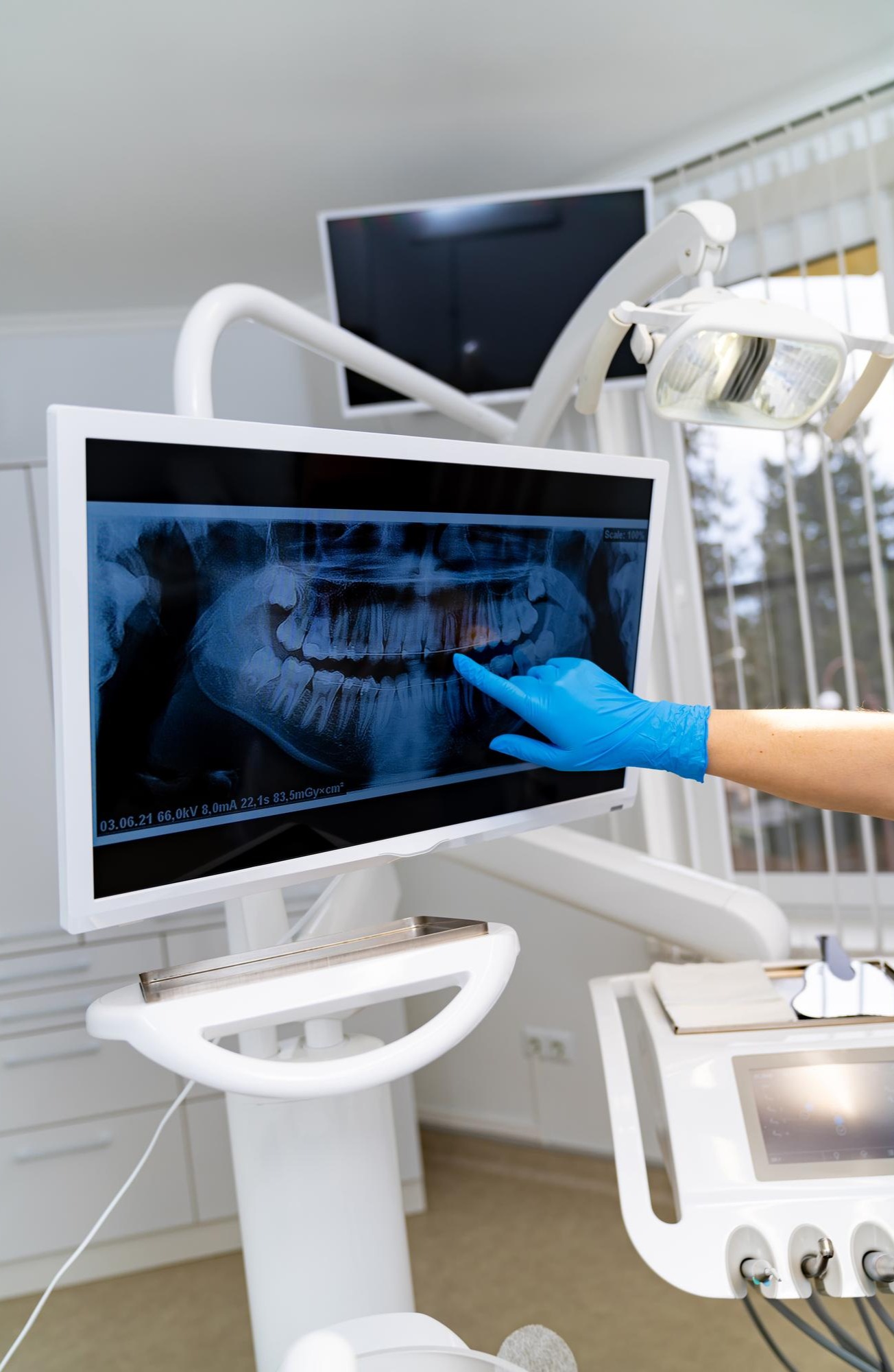 How Digital Dental X-Rays Help Dentists Detect Problems Earlier