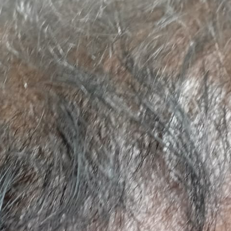 Vibha skin