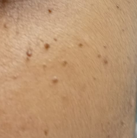 Vibha skin