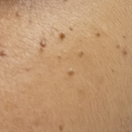 Vibha skin