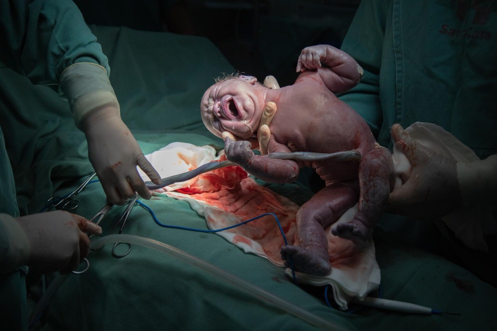 Cesarean Section Care in Thane With a Clear Recovery Plan
