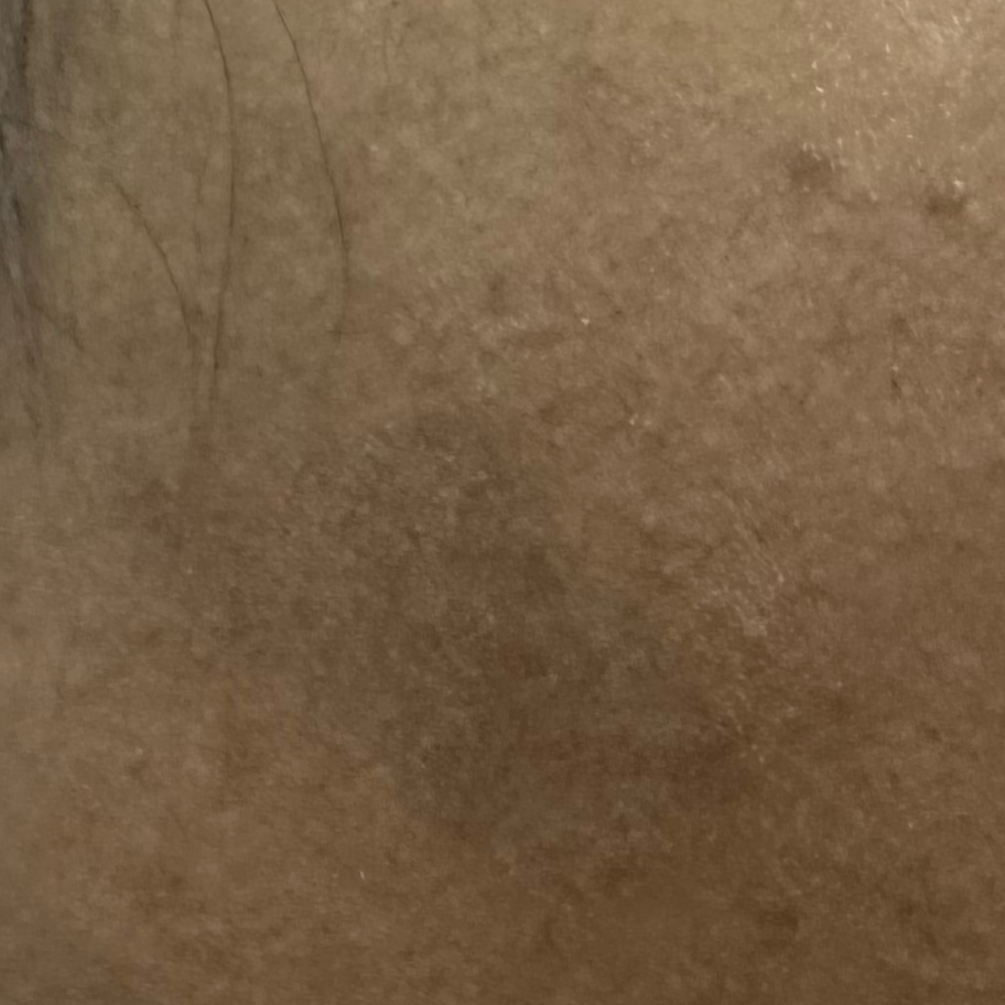 Vibha skin
