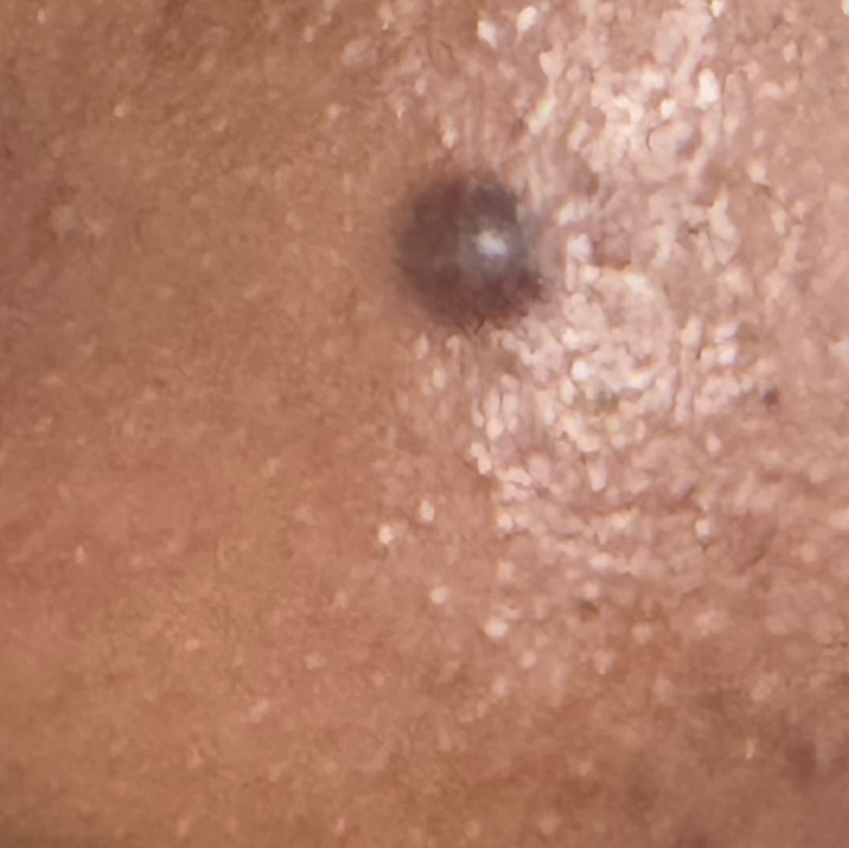 Vibha skin