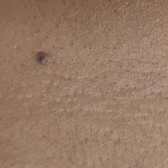Vibha skin