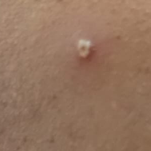 Vibha skin