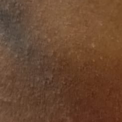 Vibha skin