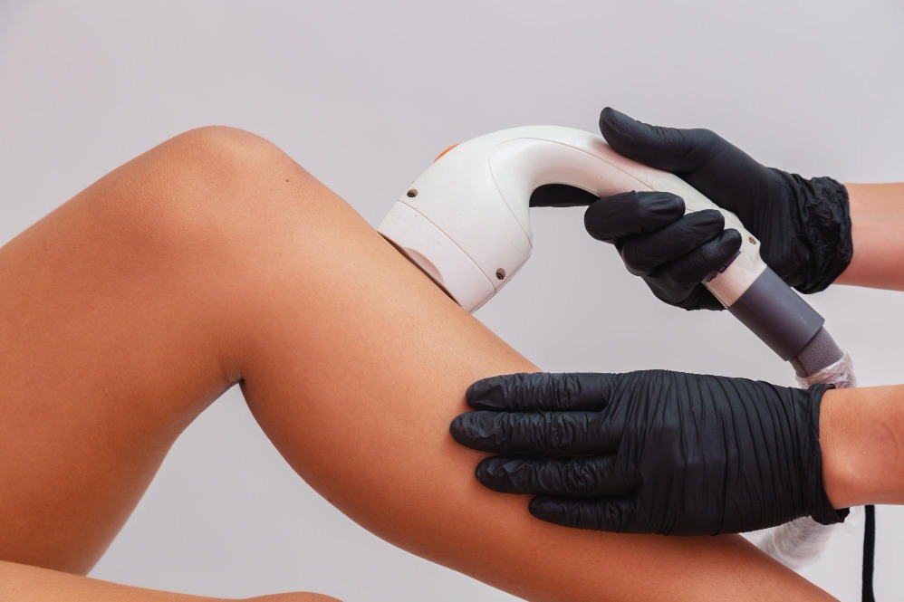 How to Choose the Right Diode Laser Hair Reduction Treatment