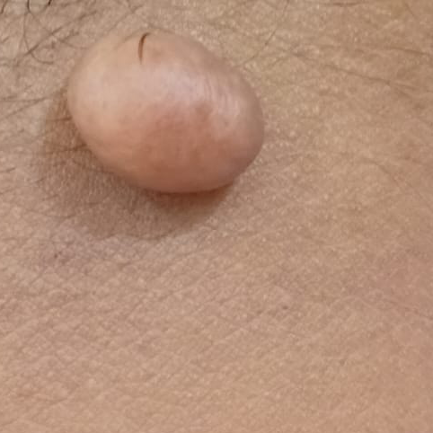 Vibha skin