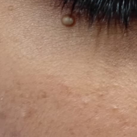 Vibha skin