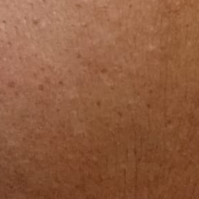 Vibha skin