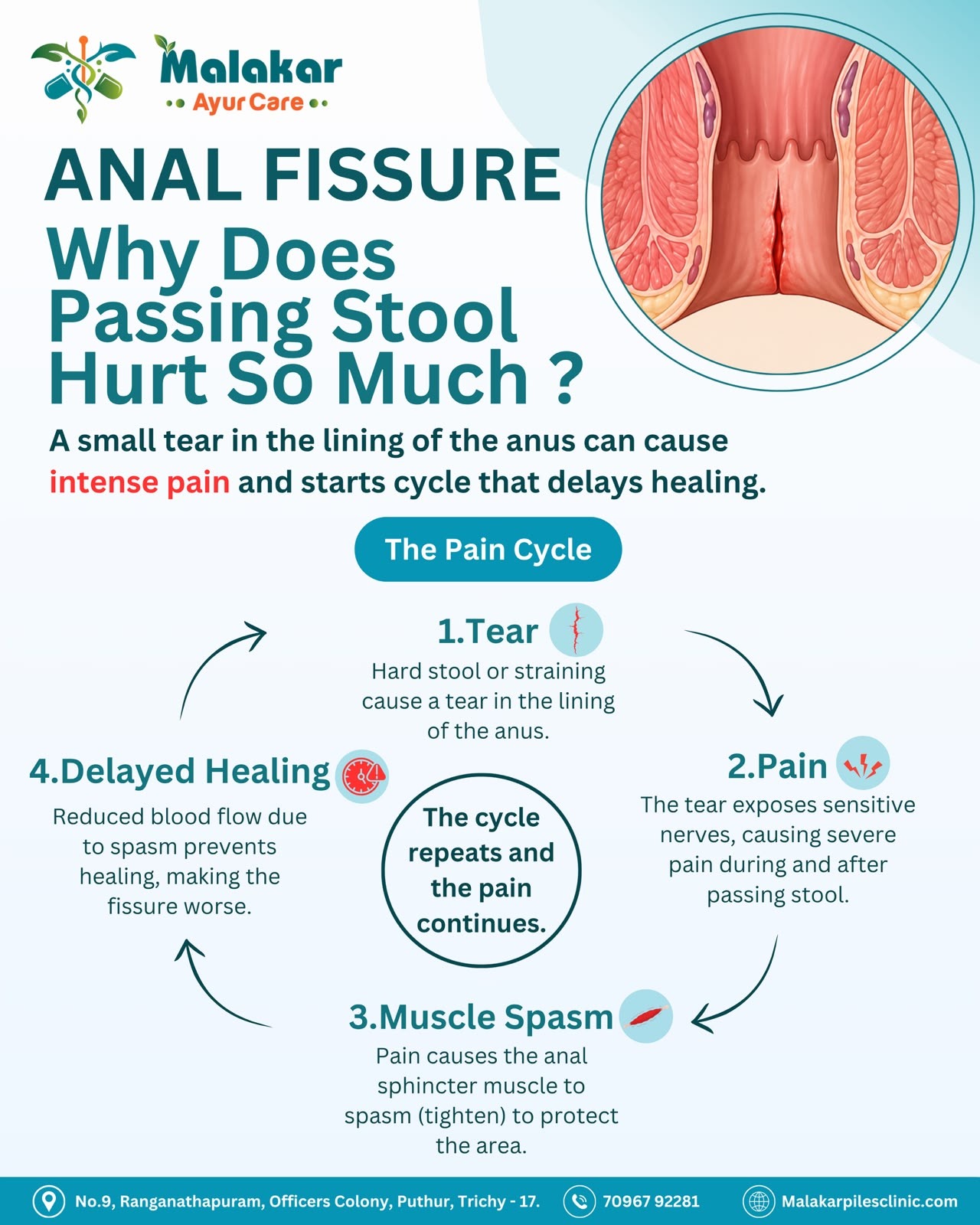 Anorectal Clinic in Thillai nagar trichy main image