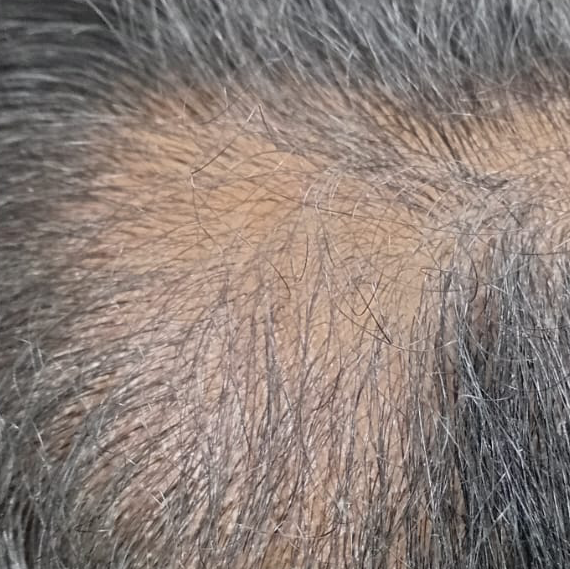 Vibha skin