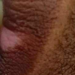 Vibha skin