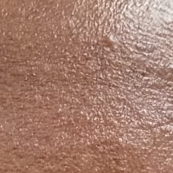 Vibha skin