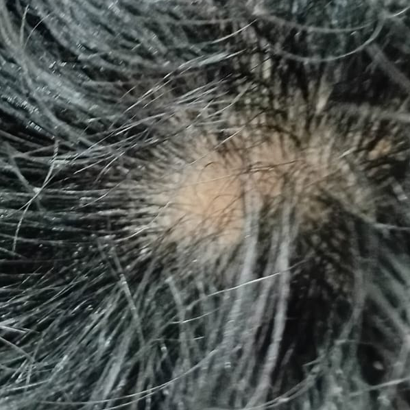 Vibha skin