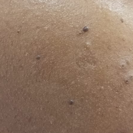 Vibha skin