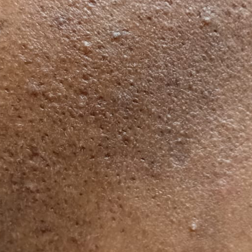 Vibha skin