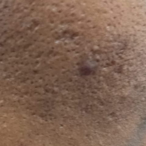 Vibha skin