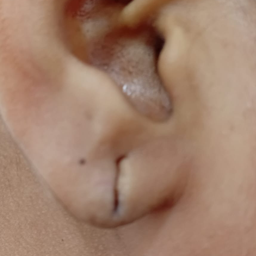 Vibha skin