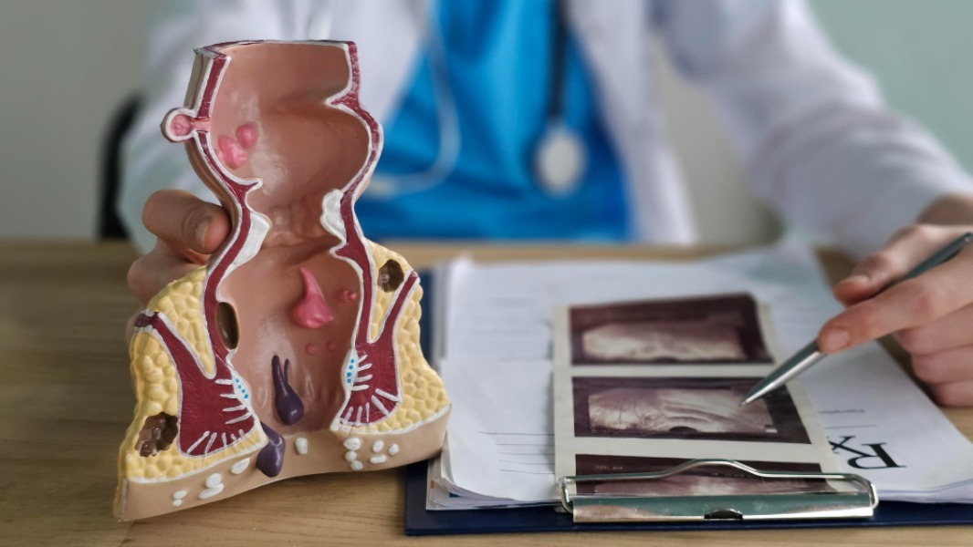 Fistula and Fissure Treatment in Pune How to Tell the Difference