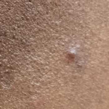 Vibha skin
