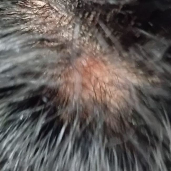 Vibha skin