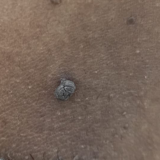 Vibha skin