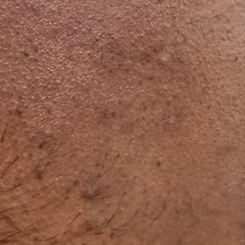 Vibha skin