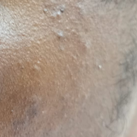 Vibha skin