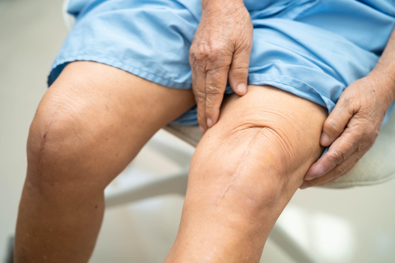 Total Knee Replacement in Chennai and Signs It May Be Time for a Surgical Assessment main image