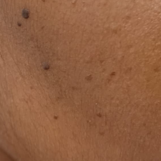 Vibha skin