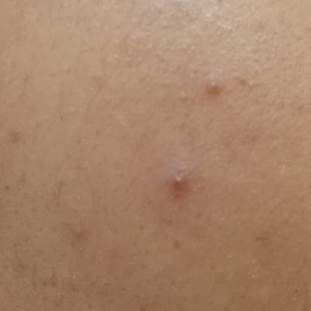 Vibha skin