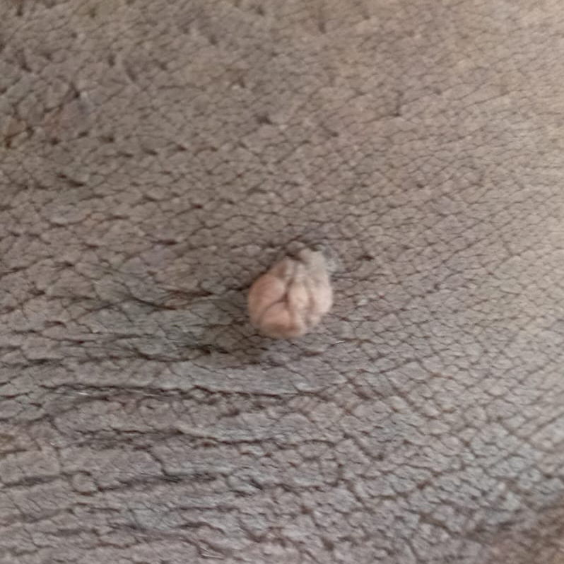 Vibha skin
