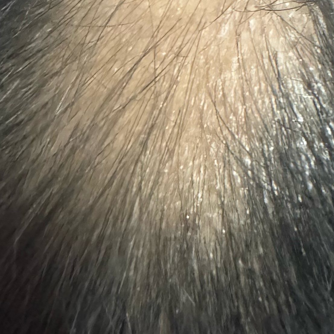 Vibha skin