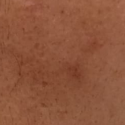 Vibha skin