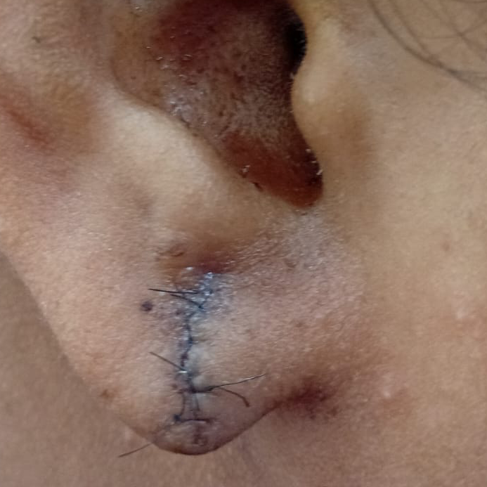 Vibha skin