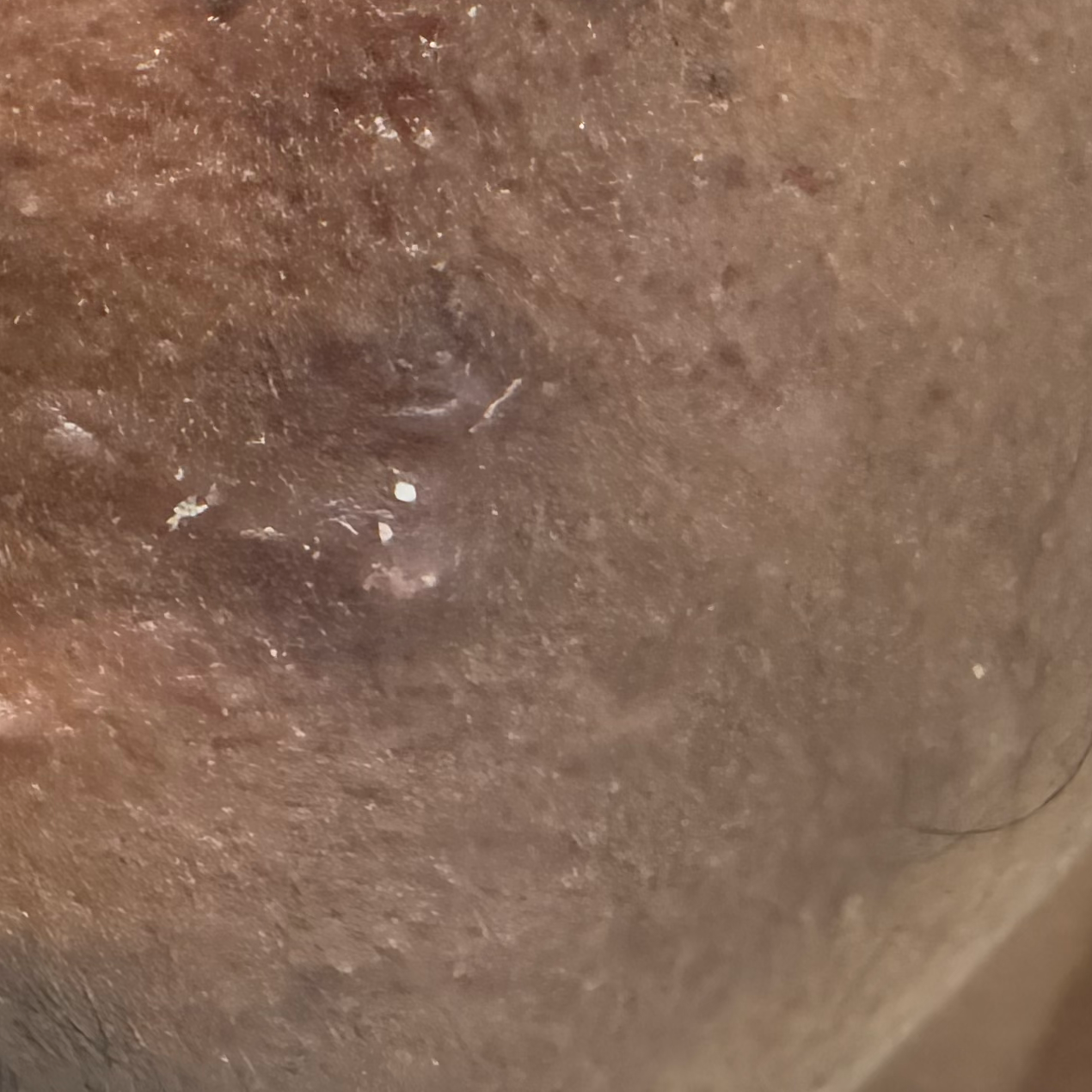 Vibha skin
