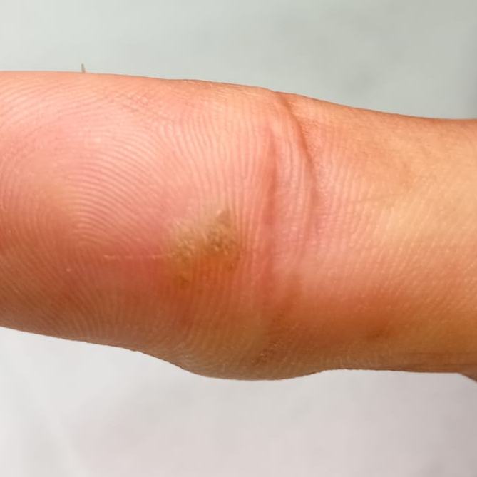 Vibha skin