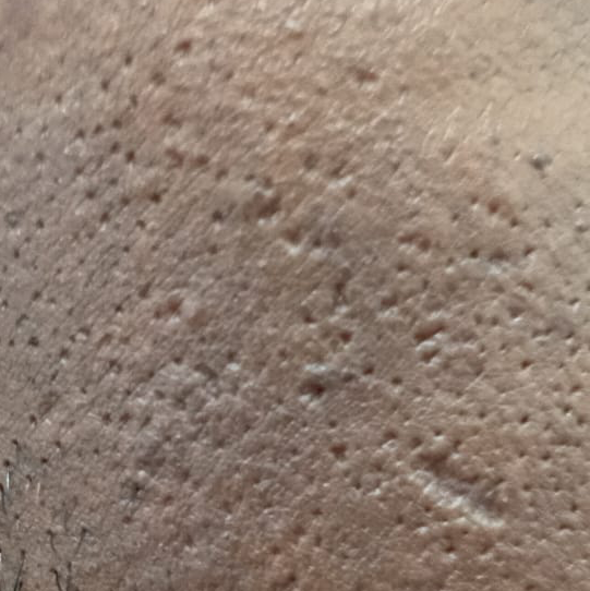 Vibha skin
