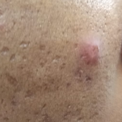 Vibha skin