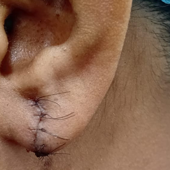 Vibha skin