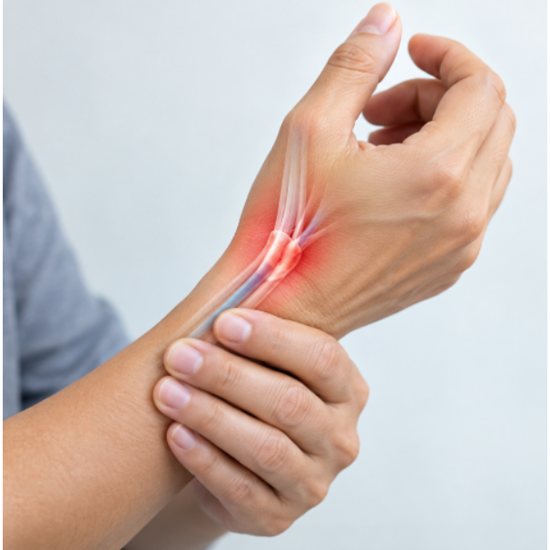 De Quervain’s Tenosynovitis Treatment for Persistent Thumb Side Wrist Pain