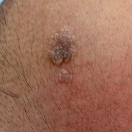 Vibha skin