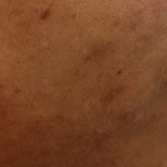 Vibha skin