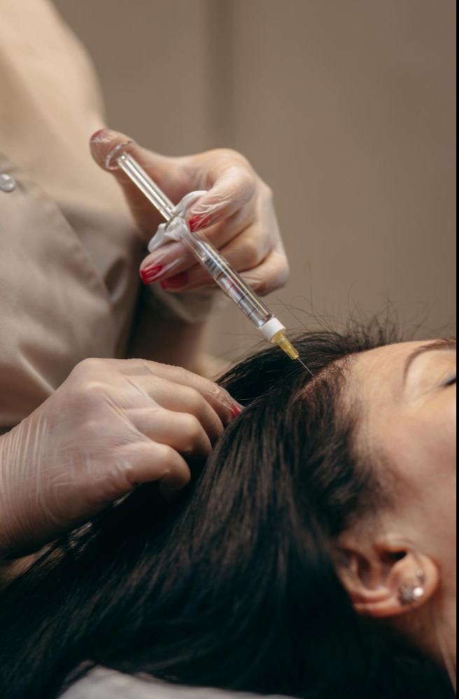 What to Know About PRP Hair Treatment Before Starting Hair Restoration