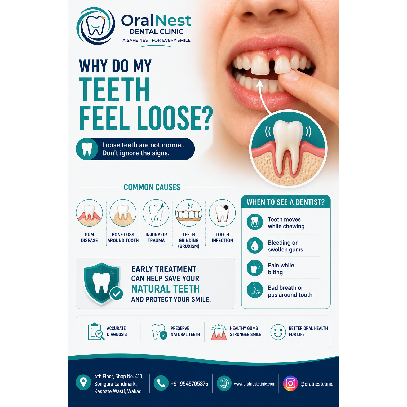 Why Do My Teeth Feel Loose?