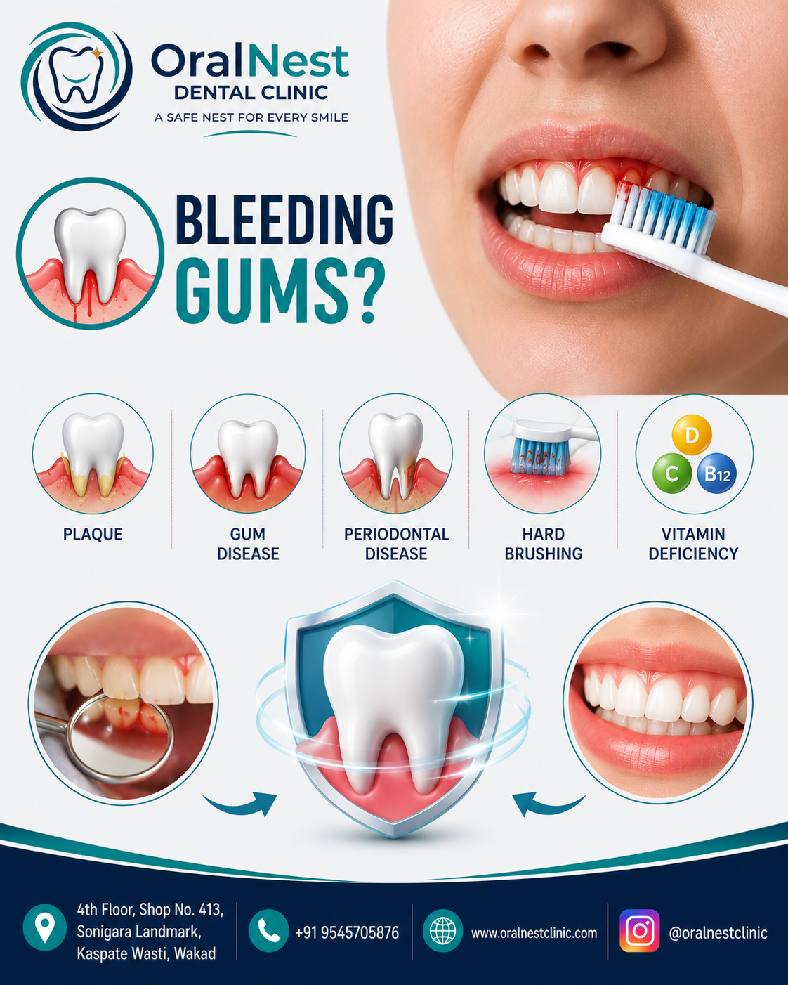 Why Are My Gums Bleeding While Brushing?