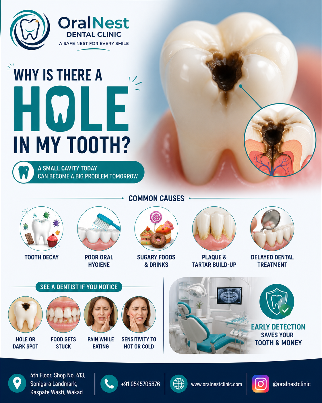 Why Is There a Hole in My Tooth?