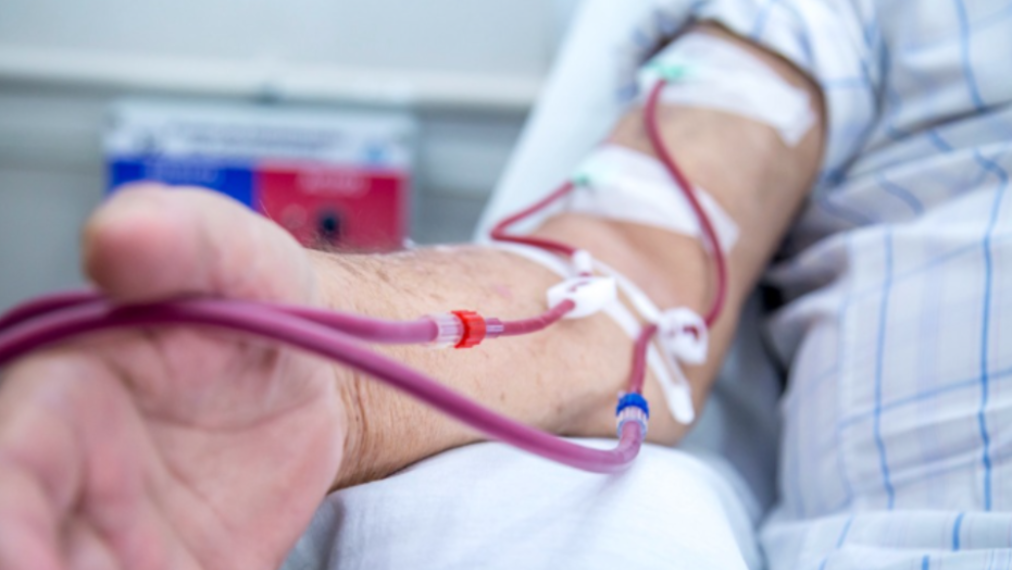 Dialysis in Teen Hath Naka How Doctors Decide When Treatment Is Needed